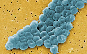 Bacteria, Acinetobacter Baumanii. (Foto/Archivo)