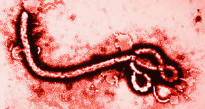 Virus del ebola. (Foto/Suministrada)